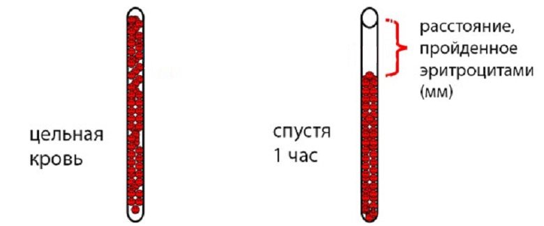 Оседание эритроцитов